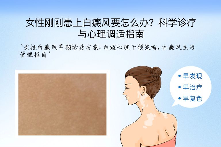 女性刚刚患上白癜风要怎么办？科学诊疗与心理调适指南”