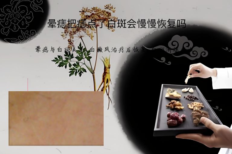 晕痣把痣点了白斑会慢慢恢复吗”