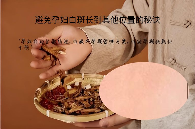 避免孕妇白斑长到其他位置的秘诀