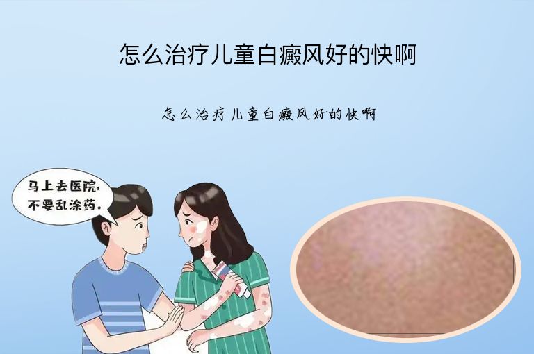 怎么治疗儿童白癜风好的快啊”