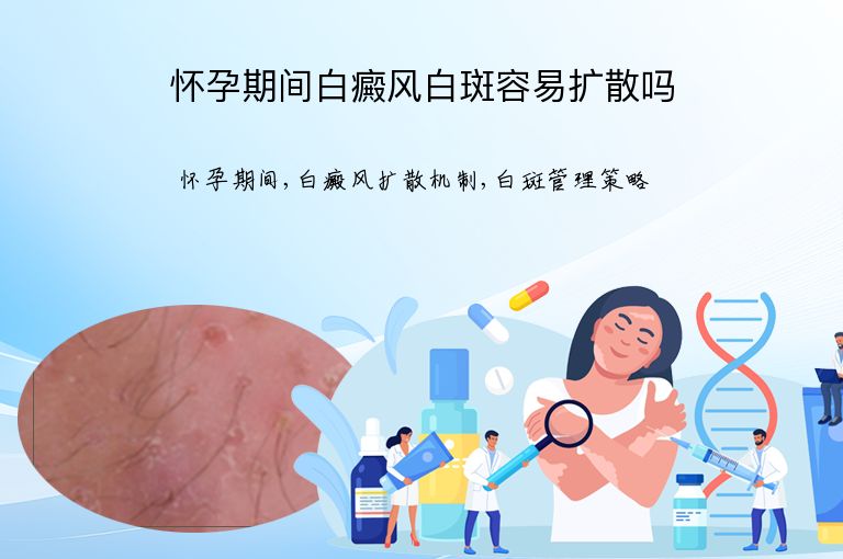 https://www.bdfsjzyy.com/d/file/p/b6f9650068f8e49e1acb5f5206d3ed94.jpeg