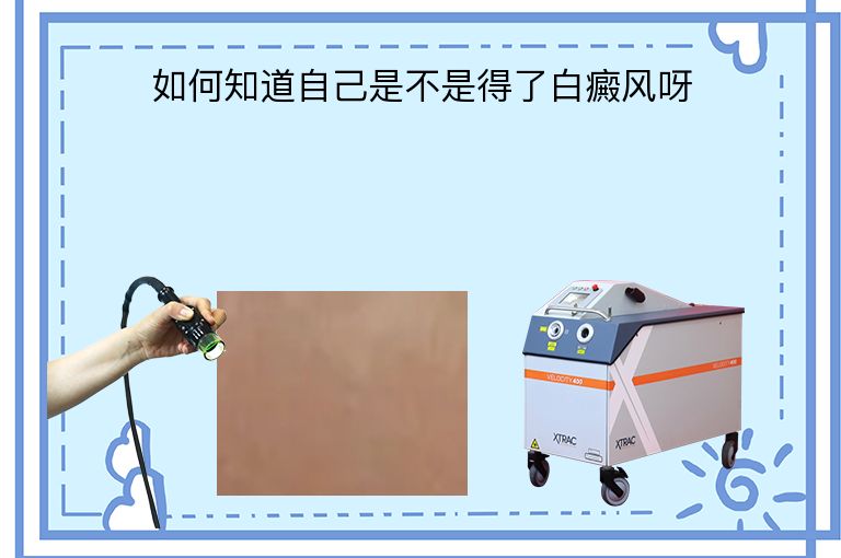 https://www.bdfsjzyy.com/d/file/p/be3b39661ee77daa16bc708e6faa4b77.jpeg
