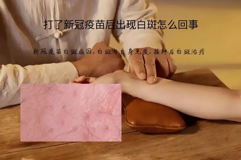 打了新冠疫苗后出现白斑怎么回事”