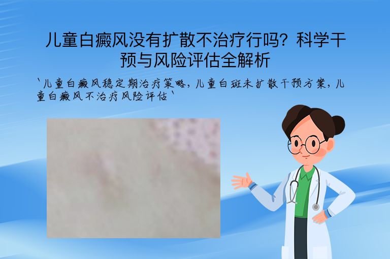 儿童白癜风没有扩散不治疗行吗?科学干预与风险评估全解析