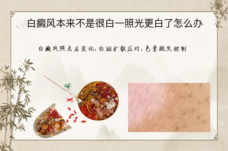 https://www.bdfsjzyy.com/d/file/p/1acb2af6cfd92676801bc81fd957d95b.jpeg