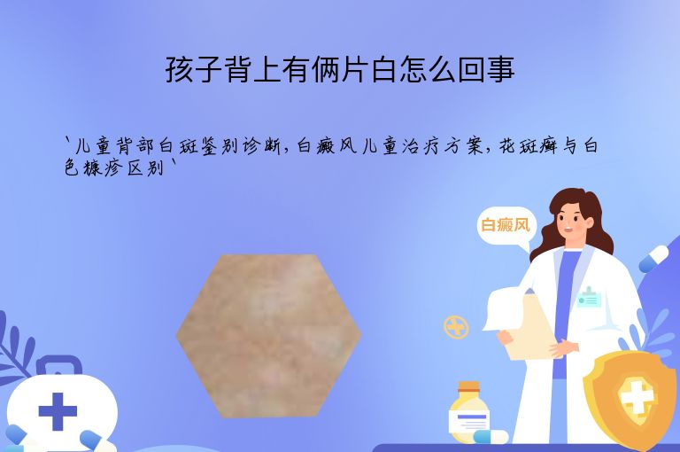 孩子背上有俩片白怎么回事