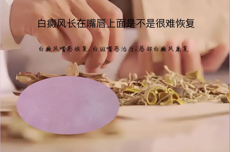 白癜风长在嘴唇上面是不是很难恢复”