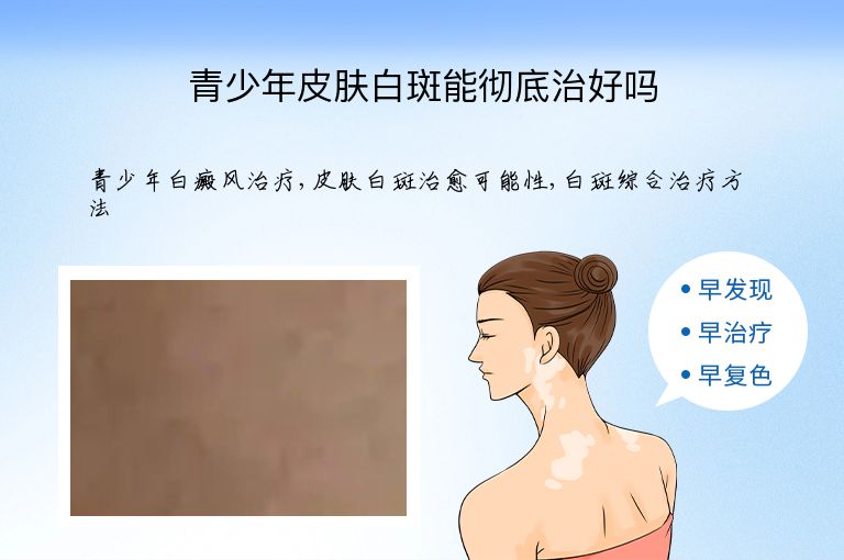 青少年皮肤白斑能彻底治好吗”