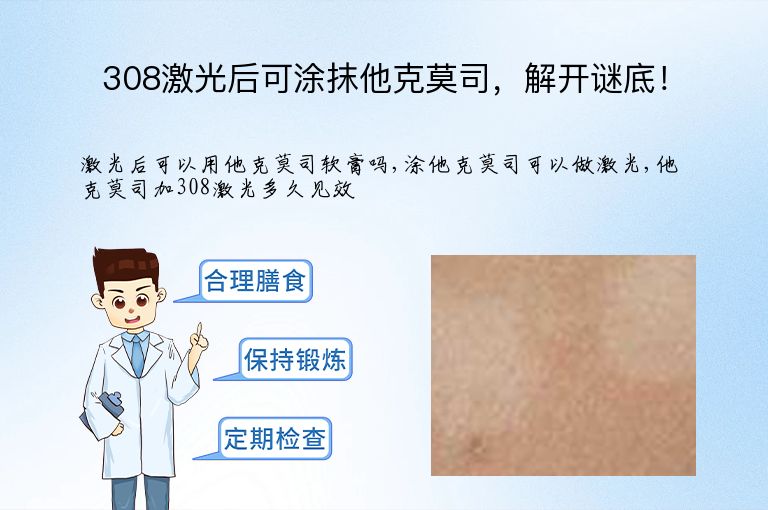 308激光后可涂抹他克莫司,解开谜底!”