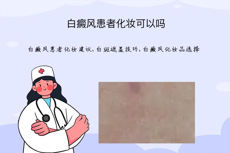 白癜风患者化妆可以吗”