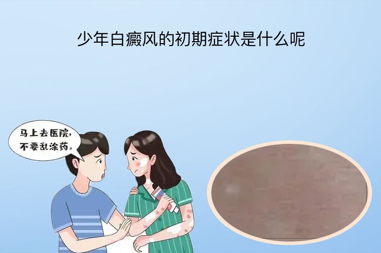 少年白癜风的初期症状是什么呢