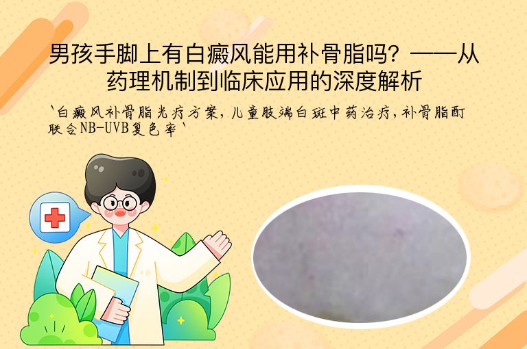 男孩手脚上有白癜风能用补骨脂吗?——从药理机制到临床应用的深度解析