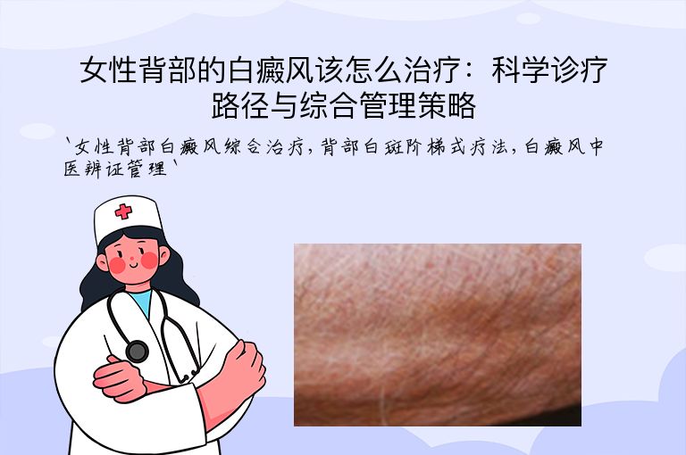 女性背部的白癜风该怎么治疗：科学诊疗路径与综合管理策略