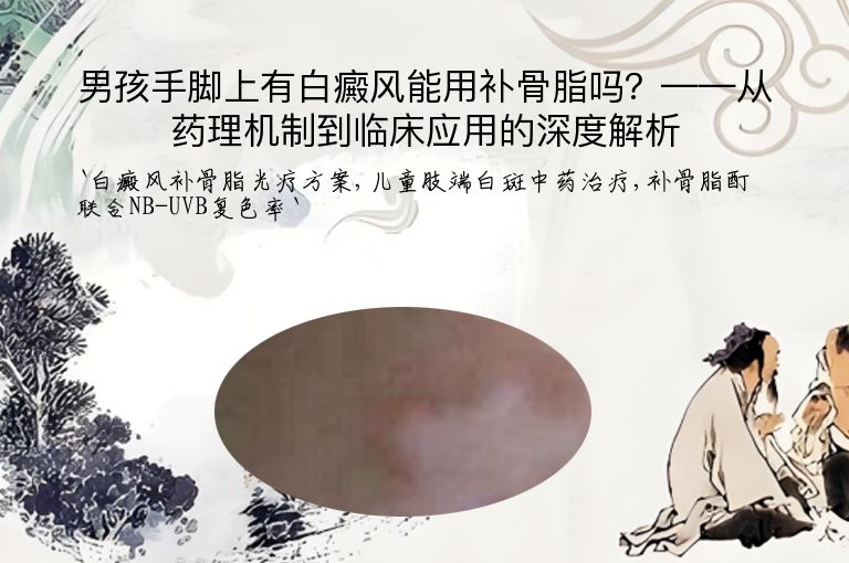 男孩手脚上有白癜风能用补骨脂吗?——从药理机制到临床应用的深度解析
