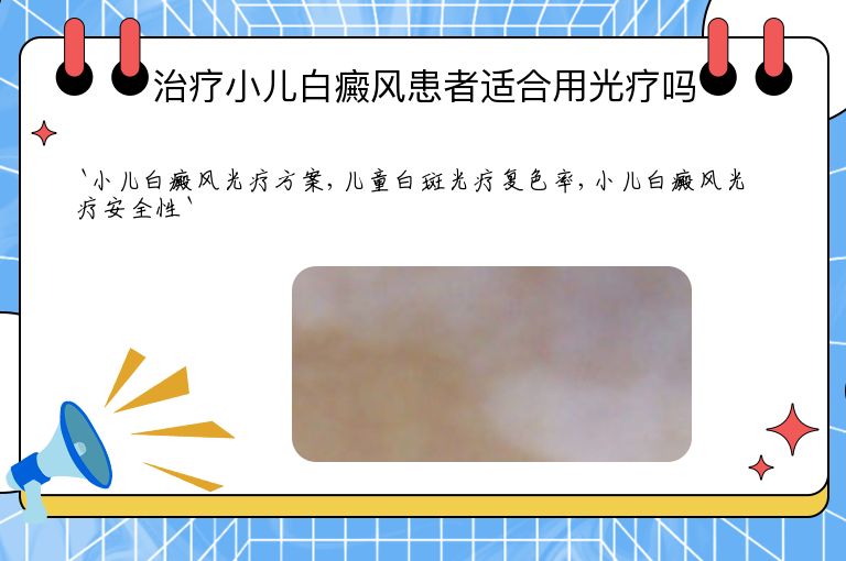 治疗小儿白癜风患者适合用光疗吗