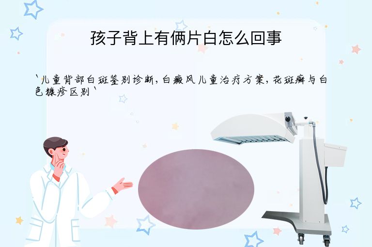 孩子背上有俩片白怎么回事