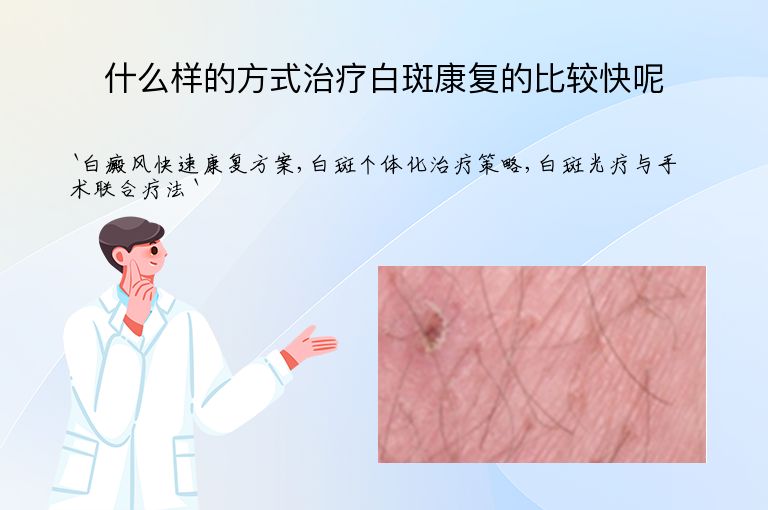 什么样的方式治疗白斑康复的比较快呢
