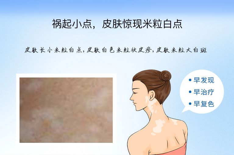 祸起小点，皮肤惊现米粒白点”