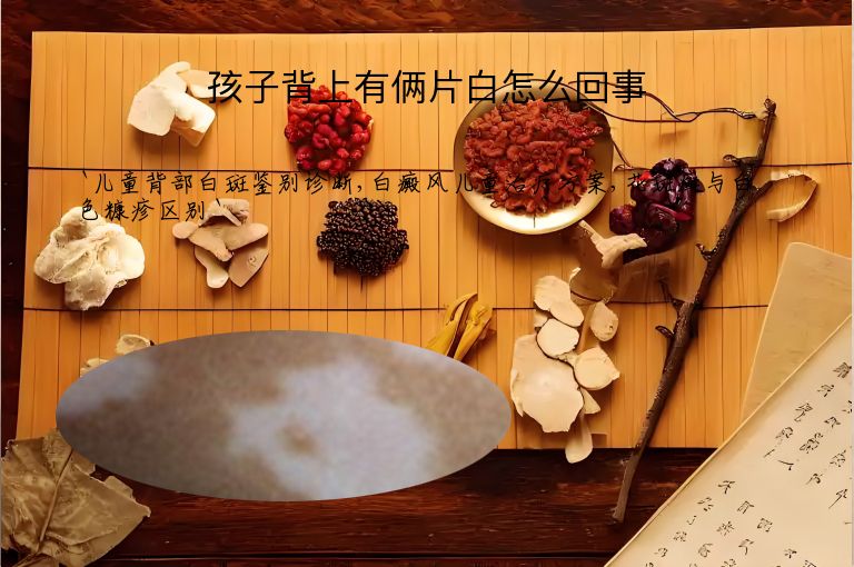 孩子背上有俩片白怎么回事