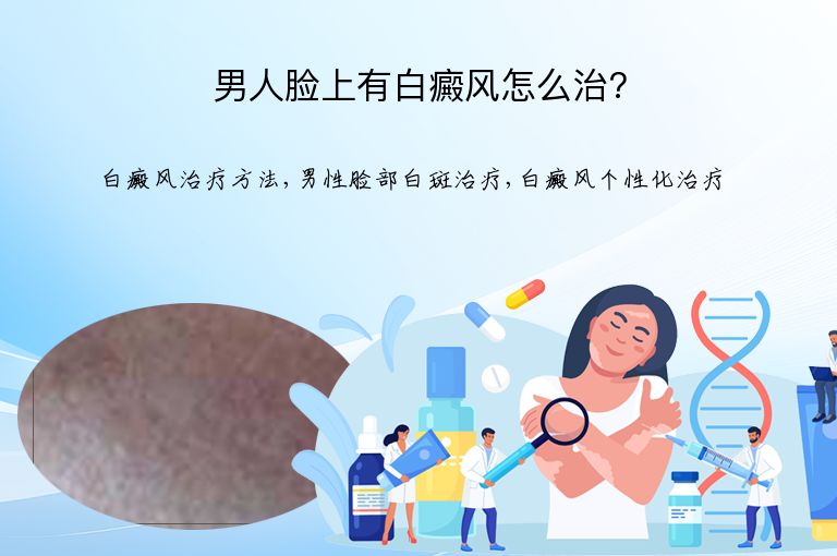 男人脸上有白癜风怎么治?”