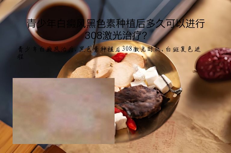 青少年白癜风黑色素种植后多久可以进行308激光治疗?”