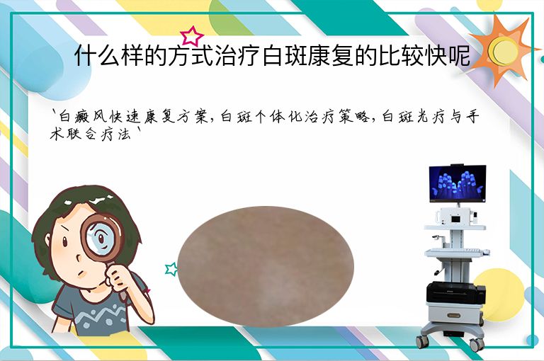 什么样的方式治疗白斑康复的比较快呢