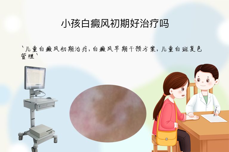 小孩白癜风初期好治疗吗