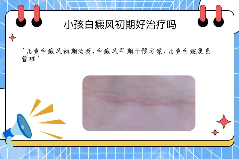 小孩白癜风初期好治疗吗