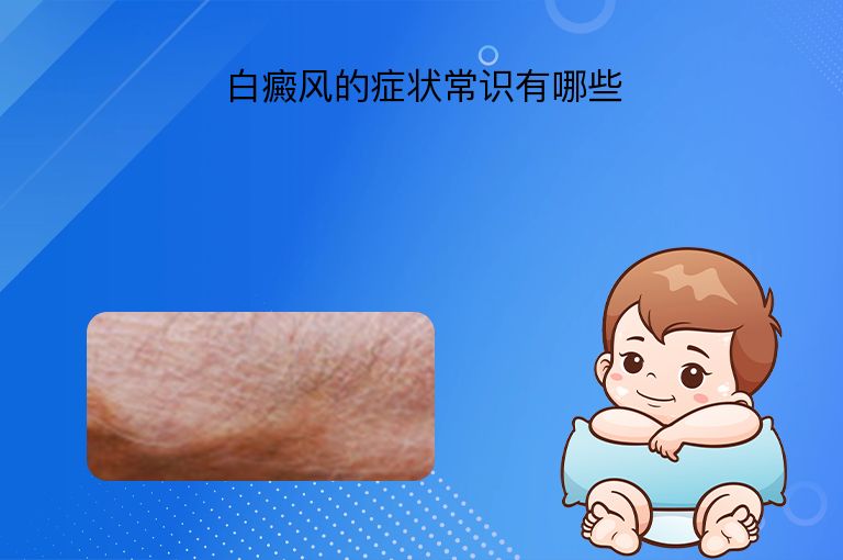 https://www.bdfsjzyy.com/d/file/p/8aaa216c5a27626fe3d22555ae3f5d78.jpeg