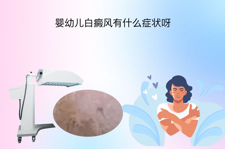 婴幼儿白癜风有什么症状呀