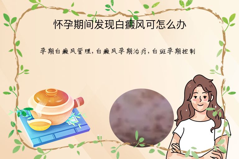 怀孕期间发现白癜风可怎么办”