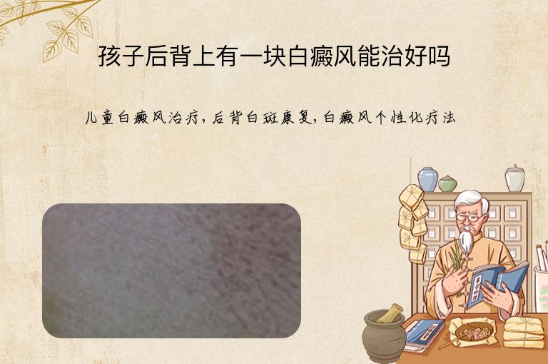 https://www.bdfsjzyy.com/d/file/p/ed61e74d9d9a7cc30045fe48f987cb83.jpeg