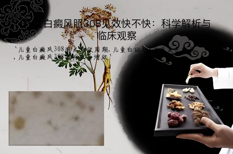 儿童白癜风照308见效快不快:科学解析与临床观察