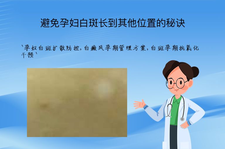避免孕妇白斑长到其他位置的秘诀