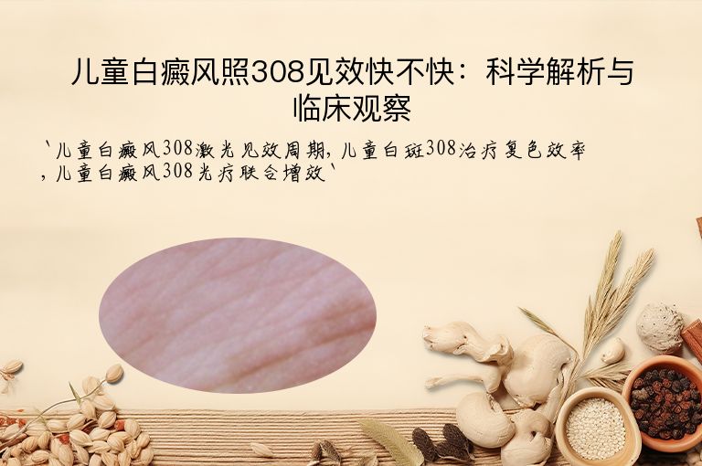 儿童白癜风照308见效快不快:科学解析与临床观察