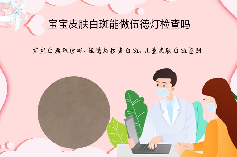 宝宝皮肤白斑能做伍德灯检查吗”