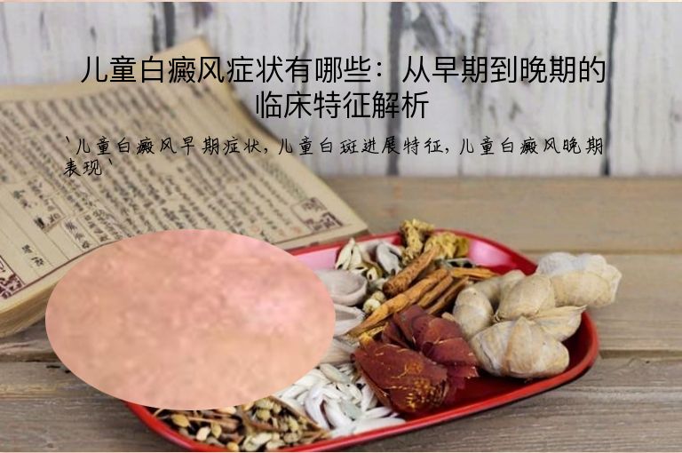 儿童白癜风症状有哪些：从早期到晚期的临床特征解析