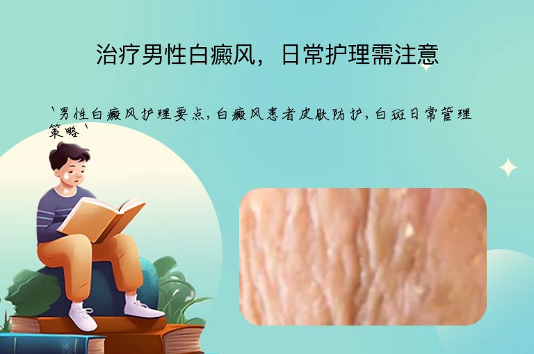 治疗男性白癜风,日常护理需注意