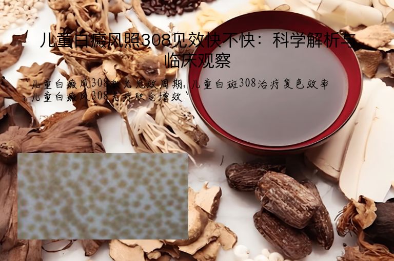 儿童白癜风照308见效快不快：科学解析与临床观察