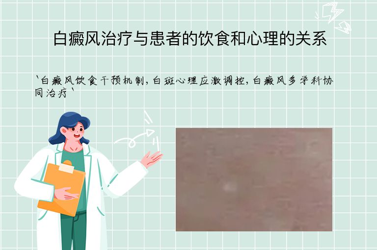 白癜风治疗与患者的饮食和心理的关系”
