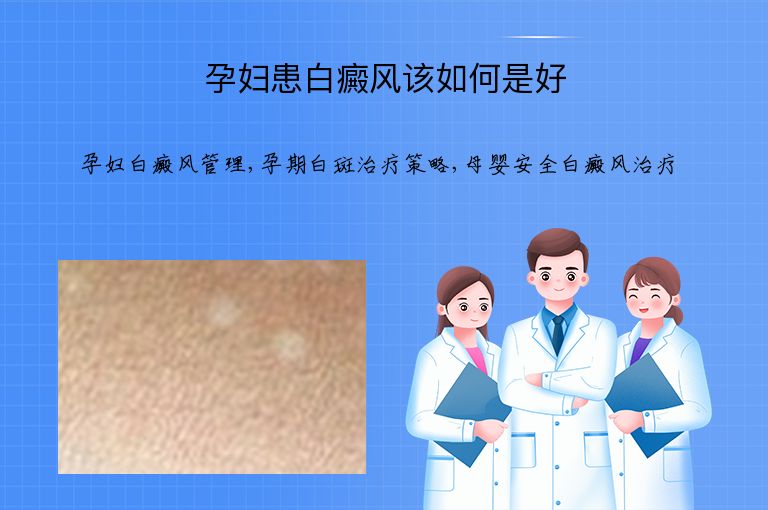孕妇患白癜风该如何是好”