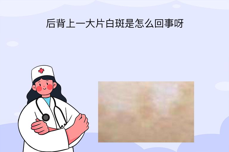 后背上一大片白斑是怎么回事呀”