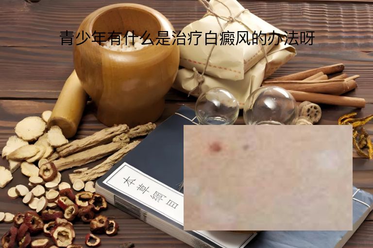 青少年有什么是治疗白癜风的办法呀”