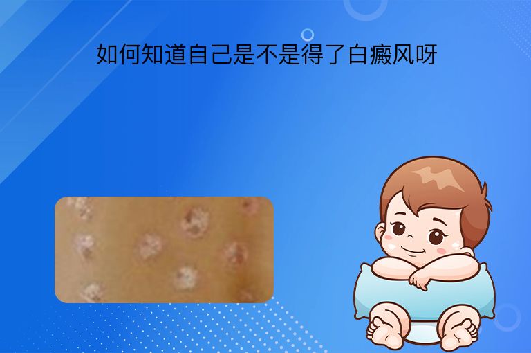 https://www.bdfsjzyy.com/d/file/p/3dd8933c980bef6ef892f846ea000322.jpeg