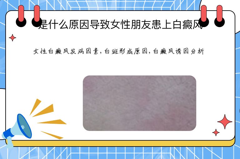 是什么原因导致女性朋友患上白癜风”