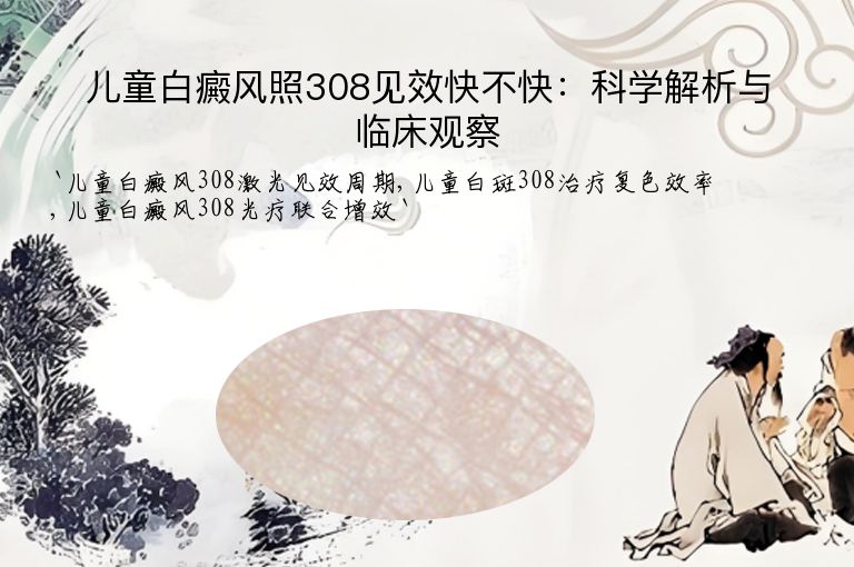 儿童白癜风照308见效快不快:科学解析与临床观察