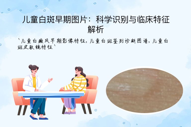 儿童白斑早期图片：科学识别与临床特征解析