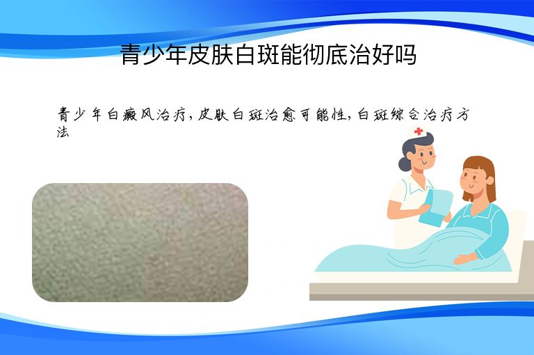 青少年皮肤白斑能彻底治好吗”