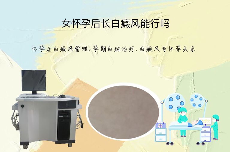 https://www.bdfsjzyy.com/d/file/p/2916b683be1a6164a3e88277c60c9065.jpeg