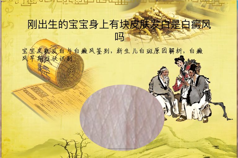 刚出生的宝宝身上有块皮肤发白是白癜风吗”
